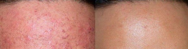 СИНА УМА ГЛИНА пакување од 100гр - Image 3