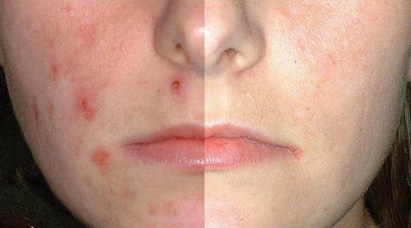 СИНА УМА ГЛИНА пакување од 100гр - Image 2